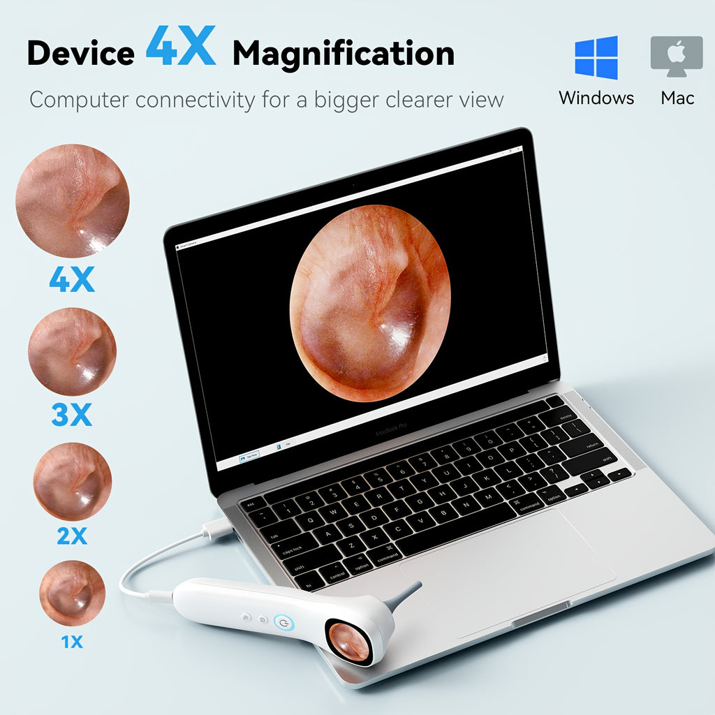 5-in-1 Ear Canal Detector with Screen & In-Ear Camera