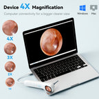 5-in-1 Ear Canal Detector with Screen & In-Ear Camera